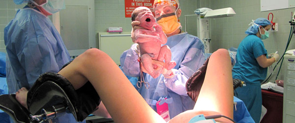 procedure-u-porodjaju