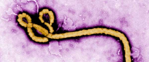sta-je-ebola